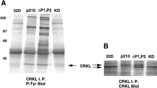 Fig. 6. Tyrosine phosphorylation of CRKL and coimmunoprecipitation of BCR-ABL and CRKL. Lysates of cells expressing the indicated constructs were (A) immunoprecipitated with CRKL antisera and immunoblotted with 4G10, a monoclonal antiphosphotyrosine antibody; (B) immunoprecipitated with CRKL antisera and immunoblotted with CRKL antisera; (C) immunoprecipitated with CRKL antisera and immunoblotted with an ABL MoAb. KD refers to a tyrosine kinase defective mutant of BCR-ABL. Molecular weight markers are indicated on the left side of the panel.