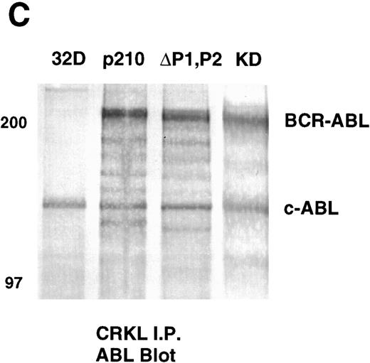 Fig. 6. Tyrosine phosphorylation of CRKL and coimmunoprecipitation of BCR-ABL and CRKL. Lysates of cells expressing the indicated constructs were (A) immunoprecipitated with CRKL antisera and immunoblotted with 4G10, a monoclonal antiphosphotyrosine antibody; (B) immunoprecipitated with CRKL antisera and immunoblotted with CRKL antisera; (C) immunoprecipitated with CRKL antisera and immunoblotted with an ABL MoAb. KD refers to a tyrosine kinase defective mutant of BCR-ABL. Molecular weight markers are indicated on the left side of the panel.