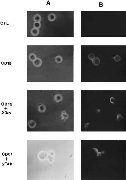 Fig. 1. Cross-linking induced patching and capping of CD15. MM6 cells (1 × 106) were suspended in culture medium containing 10 μg FITC-conjugated anti-CD15 or anti-CD31 MoAb per mL and incubated at 4°C for 20 minutes. Cells were then washed and incubated with F(ab) ′2 fragments of goat anti-mouse IgM (for CD15) or IgG (for CD31) at a concentration of 10 μg/mL at 4°C for 20 minutes. Cells were washed and then warmed to 37°C for 10 minutes and examined by fluorescent microscopy. Shown are phase-fluoresecence pairs (A and B, respectively) for cells incubated with anti-CD15 alone (second row), anti-CD15 plus F(ab) ′2 secondary antibody (third row), and anti-CD31 plus F(ab) ′2 secondary antibody (bottom). The top row shows cells incubated with the F(ab) ′2 secondary antibody in the absence of primary antibody.