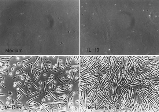 Fig. 2. Morphology of monocytes cultured in M-CSF or M-CSF + IL-10. Monocytes were incubated with rhIL-10 (25 ng/mL), rhM-CSF (50 ng/mL), M-CSF + IL-10, or medium alone for 7 days.