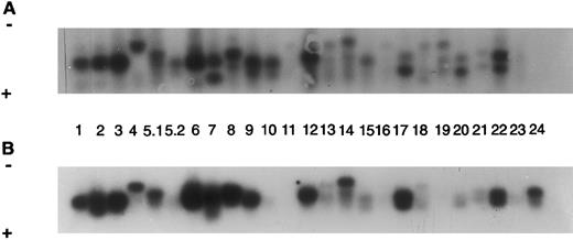Fig. 1. Autoradiograms and histogram for TCR Vβ study from SS patient 6 (SS-6, Table 2). The signals were detected by Southern blot hybridized to a labeled constant primer Cβ and quantitated on a Instant Imager. The blots were then exposed to film overnight and the signals for each receptor gene studied (numbers) are shown for blood (A) and for skin (B). A histogram with the relative amounts of each signal are shown as a percentage of the total counts for blood and for skin (C).