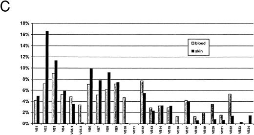 Fig. 1. Autoradiograms and histogram for TCR Vβ study from SS patient 6 (SS-6, Table 2). The signals were detected by Southern blot hybridized to a labeled constant primer Cβ and quantitated on a Instant Imager. The blots were then exposed to film overnight and the signals for each receptor gene studied (numbers) are shown for blood (A) and for skin (B). A histogram with the relative amounts of each signal are shown as a percentage of the total counts for blood and for skin (C).