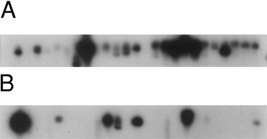 Fig. 2. Autoradiograms and histogram from SS-1 patient, Table 2. Signals from blood (A) and from skin (B) were counted and the percentages of the total for both blood and skin are shown in the histogram (C).