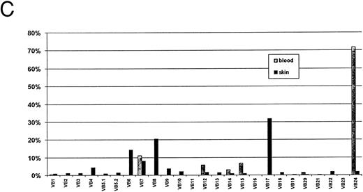 Fig. 2. Autoradiograms and histogram from SS-1 patient, Table 2. Signals from blood (A) and from skin (B) were counted and the percentages of the total for both blood and skin are shown in the histogram (C).