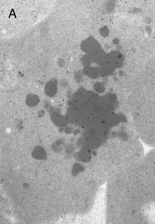 Fig. 3. Electron micrographs of erythroblastic inclusions from sections of marrow immunogold-labeled with mouse monoclonal antibody. Inclusions from case no. 1 show positive reactions with antibody against α-globin chains (A) and β-globin chains (B). Inclusions from case no. 2 show positive reactions with antibody against α-globin chains (C) and β-globin chains (D). Magnifications: A, × 32,000; B, × 38,000; C, × 32,000; D, × 37,000.