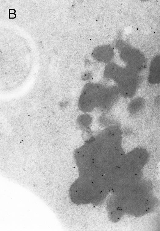 Fig. 3. Electron micrographs of erythroblastic inclusions from sections of marrow immunogold-labeled with mouse monoclonal antibody. Inclusions from case no. 1 show positive reactions with antibody against α-globin chains (A) and β-globin chains (B). Inclusions from case no. 2 show positive reactions with antibody against α-globin chains (C) and β-globin chains (D). Magnifications: A, × 32,000; B, × 38,000; C, × 32,000; D, × 37,000.