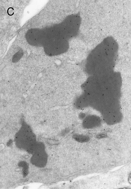 Fig. 3. Electron micrographs of erythroblastic inclusions from sections of marrow immunogold-labeled with mouse monoclonal antibody. Inclusions from case no. 1 show positive reactions with antibody against α-globin chains (A) and β-globin chains (B). Inclusions from case no. 2 show positive reactions with antibody against α-globin chains (C) and β-globin chains (D). Magnifications: A, × 32,000; B, × 38,000; C, × 32,000; D, × 37,000.
