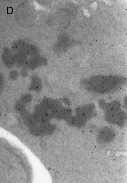 Fig. 3. Electron micrographs of erythroblastic inclusions from sections of marrow immunogold-labeled with mouse monoclonal antibody. Inclusions from case no. 1 show positive reactions with antibody against α-globin chains (A) and β-globin chains (B). Inclusions from case no. 2 show positive reactions with antibody against α-globin chains (C) and β-globin chains (D). Magnifications: A, × 32,000; B, × 38,000; C, × 32,000; D, × 37,000.