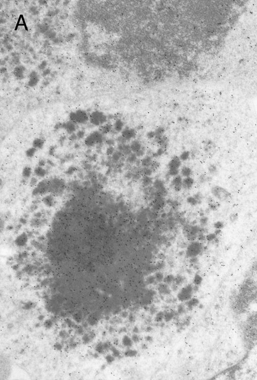 Fig. 4. Electron micrographs of erythroblastic inclusions from sections of marrow immunogold-labeled with mouse monoclonal antibody. Inclusions from a case of β-thalassemia major show a positive reaction with antibody against human α-globin chains (A, B) and no reaction with antibody against human β-globin chains (C). B shows part of the inclusion in A at higher magnification. There is virtually no labeling of inclusions in a control section that was reacted with normal mouse serum instead of a monoclonal antibody (D). Magnifications: A, × 20,000; B, × 59,000; C, × 23,000; D, × 35,000.