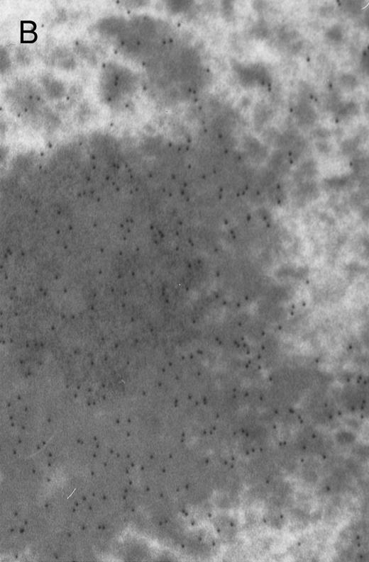 Fig. 4. Electron micrographs of erythroblastic inclusions from sections of marrow immunogold-labeled with mouse monoclonal antibody. Inclusions from a case of β-thalassemia major show a positive reaction with antibody against human α-globin chains (A, B) and no reaction with antibody against human β-globin chains (C). B shows part of the inclusion in A at higher magnification. There is virtually no labeling of inclusions in a control section that was reacted with normal mouse serum instead of a monoclonal antibody (D). Magnifications: A, × 20,000; B, × 59,000; C, × 23,000; D, × 35,000.