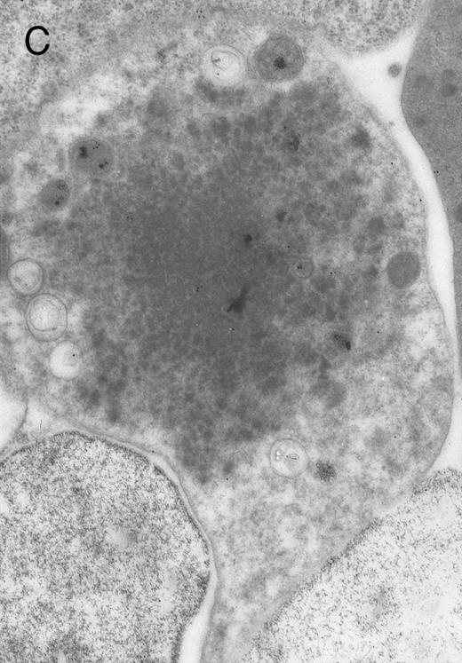 Fig. 4. Electron micrographs of erythroblastic inclusions from sections of marrow immunogold-labeled with mouse monoclonal antibody. Inclusions from a case of β-thalassemia major show a positive reaction with antibody against human α-globin chains (A, B) and no reaction with antibody against human β-globin chains (C). B shows part of the inclusion in A at higher magnification. There is virtually no labeling of inclusions in a control section that was reacted with normal mouse serum instead of a monoclonal antibody (D). Magnifications: A, × 20,000; B, × 59,000; C, × 23,000; D, × 35,000.