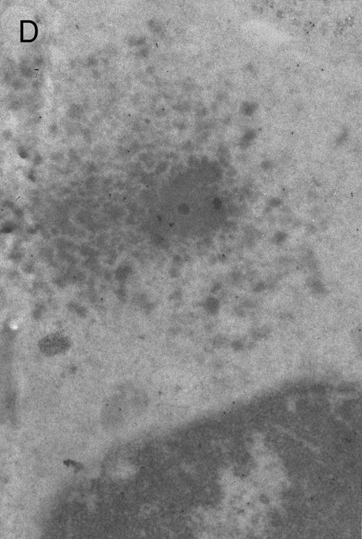 Fig. 4. Electron micrographs of erythroblastic inclusions from sections of marrow immunogold-labeled with mouse monoclonal antibody. Inclusions from a case of β-thalassemia major show a positive reaction with antibody against human α-globin chains (A, B) and no reaction with antibody against human β-globin chains (C). B shows part of the inclusion in A at higher magnification. There is virtually no labeling of inclusions in a control section that was reacted with normal mouse serum instead of a monoclonal antibody (D). Magnifications: A, × 20,000; B, × 59,000; C, × 23,000; D, × 35,000.