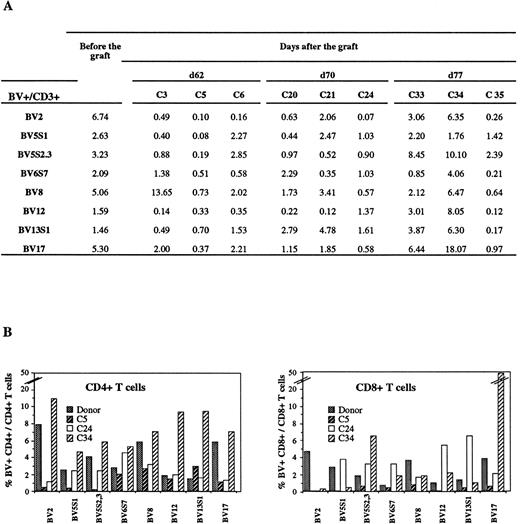 Fig. 2. Modifications of the Vβ subset representation in chimeras. (A) The percentage of Vβ+ (BV) CD3+ among total CD3+ T cells from fresh PBL and from the spleen of 9 chimeras killed at times indicated was determined by FACS analysis using anti-CD3 MoAbs and MoAbs specific for several regions of the human TCR. (B and C) The same analysis was performed on human CD4+ (B) and CD8+ (C) T cells from donor and from 3 chimeras.