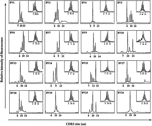 Fig. 3. Comparison of CDR3 size distribution of the human Vβ subsets before and after engraftment. RNA extraction from fresh donor's PBL or from spleen cells of chimera C5, killed at day 65 postengraftment, PCR and run off reactions were performed as described in Materials and Methods. Patterns represent the distribution, measured as relative fluorescence intensity, of the aa size of the CDR3 for the PCR reaction products obtained for each Vβ subset studied. Patterns on the bottom left correspond to chimera's profiles and patterns on the top right correspond to fresh donor's profiles. Each peak corresponds to a defined CDR3 size.