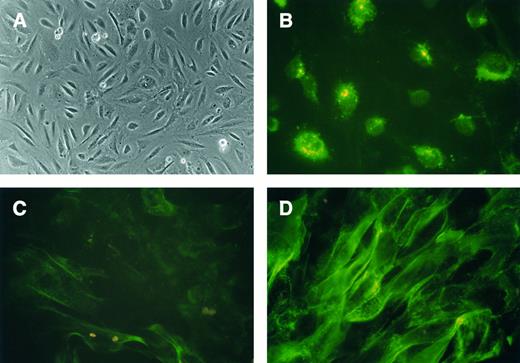 Fig. 1. Characterization of BMEC-1 cells. (A) Phase-contrast microscopy of a confluent monolayer of spindle-shaped BMEC-1 cells (original magnification × 100). (B) Characteristic granular immunofluorescence was observed after staining with MoAb to factor VIII/vWF (original magnification × 400). (C) ICAM-1 was weakly positive on resting BMEC-1 cells (original magnification × 400). (D) Expression of ICAM-1 was upregulated after stimulation with IL-1β (original magnification × 400).