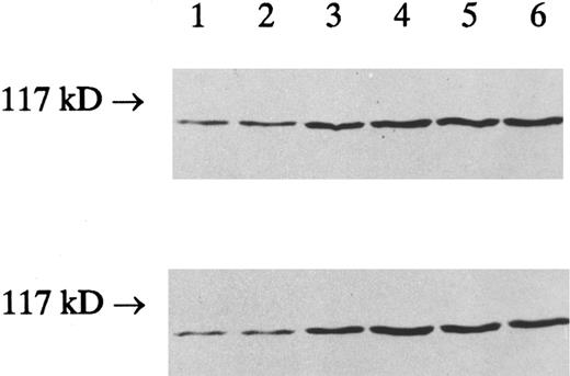 Fig. 4. The effect of IFN-γ on the amount of cPLA2 protein. HL-60 cells were incubated with 2,000 U/mL of IFN-γ for indicated times and homogenized as described in Materials and Methods. Particulate and soluble fractions from HL-60 cells were subjected to sodium dodecyl sulfate-polyacrylamide gel electrophoresis (SDS-PAGE), transferred to nitrocellulose, and immunoblotted with rabbit antihuman cPLA2 antibody. A representative Western blot of membrane pellet (upper) and crude cytosol (lower) from HL-60 cells is shown. The cPLA2 protein was shown from left as follows: control cells (lane 1), cells treated with IFN-γ (2,000 U/mL) for 30 minutes (lane 2), 4 hours (lane 3), 12 hours (lane 4), 48 hours (lane 5), and 120 hours (lane 6). The size of the molecular marker is indicated on the left side.