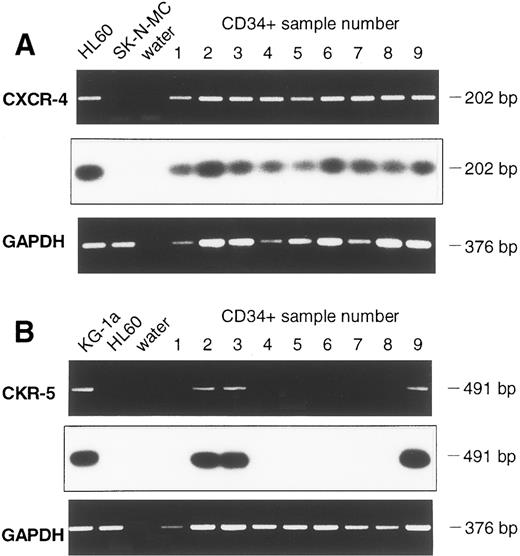 Fig. 3. Detection of CXCR-4 (A) and CKR-5 (B) mRNA in samples of CD34+ cells of 9 leukapheresis products using RT-PCR. Chemokine mRNA specific PCR, Southern Blot hybridization, and GAPDH-PCR are shown one below another. For CXCR-4 mRNA, the cell line HL60 served as a positive control and SK-N-MC and water as negative controls. CKR-5 mRNA analysis of cell line KG-1a was a positive control, whereas HL60 and water were negative controls.