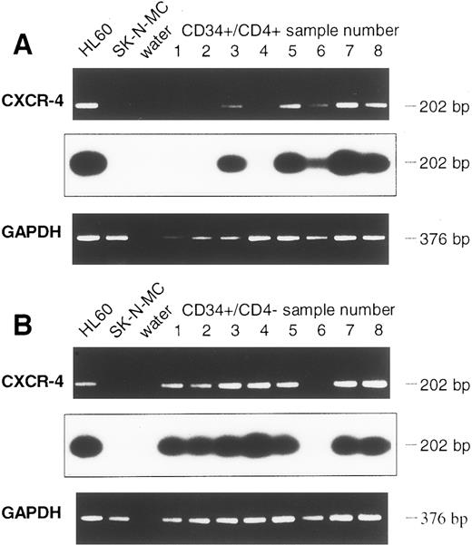 Fig. 4. Detection of CXCR-4 mRNA in CD34+ cell samples of eight further leukapheresis products, sorted for CD34+/CD4+ (A) and CD34+/CD4− (B) cells. Controls and Southern blot hybridization are corresponding to Fig 3.