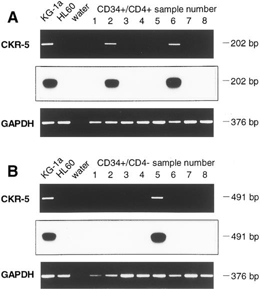 Fig. 5. Detection of CKR-5 mRNA in CD34+/CD4+ (A) and in CD34+/CD4− (B) cell samples (B). Controls and Southern blot hybridization are corresponding to Fig 3.