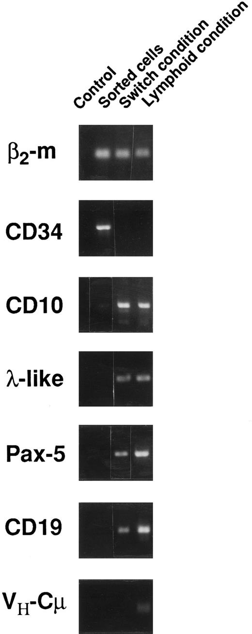 Fig. 3. Transcriptional activity of CD34+CD38lowCD19− sorted cells before and after 6 weeks of culture in either switch or lymphoid conditions. RT-PCR was performed using primers and conditions as indicated in the Materials and Methods. A control without cDNA was included in the left column of each series.