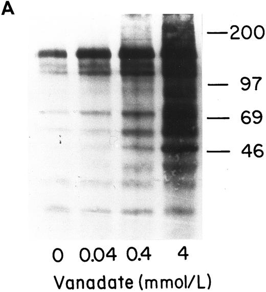 Fig. 6. Effect of increasing concentrations of vanadate on growth factor-induced protein tyrosine phosphorylation in normal (A) and PV (B) ECFC. Day-8 cells were incubated with increasing concentrations of vanadate for 1 hour at 37°C and were then exposed to rhEP at 20 U/mL and rhSCF at 100 ng/mL for 10 minutes at 37°C. The cells were lysed and then immunoprecipitated and immunoblotted with anti-pTyr antibody. The purity of the normal ECFC was 73% ± 2% and the purity of the PV ECFC was 78% ± 5%.