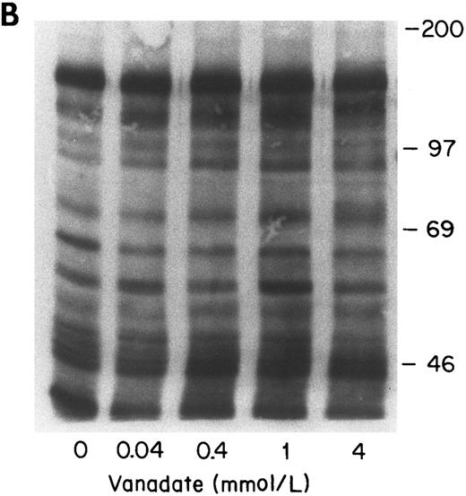 Fig. 6. Effect of increasing concentrations of vanadate on growth factor-induced protein tyrosine phosphorylation in normal (A) and PV (B) ECFC. Day-8 cells were incubated with increasing concentrations of vanadate for 1 hour at 37°C and were then exposed to rhEP at 20 U/mL and rhSCF at 100 ng/mL for 10 minutes at 37°C. The cells were lysed and then immunoprecipitated and immunoblotted with anti-pTyr antibody. The purity of the normal ECFC was 73% ± 2% and the purity of the PV ECFC was 78% ± 5%.