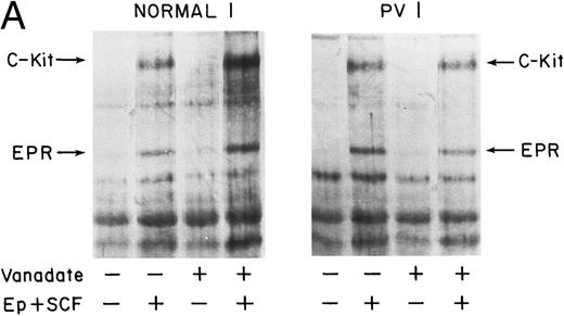 Fig. 7. Effect of vanadate on growth factorinduced protein tyrosine phosphorylation in PV and normal ECFC. Day-8 cells were incubated with rhEP at 20 U/mL and rhSCF at 100 ng/mL, or medium, for 10 minutes at 37°C after incubation at 37°C with vanadate, 0.4 mmol/L, or medium alone for 1 hour. Cell lysates were immunoprecipitated and immunoblotted with anti-pTyr antibody. The purity of the normal ECFC was 66% ± 8% (A) and 50% ± 6% (B), whereas the purity of the PV ECFC was 63% ± 3% (A) and 47% ± 6% (B).