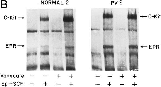 Fig. 7. Effect of vanadate on growth factorinduced protein tyrosine phosphorylation in PV and normal ECFC. Day-8 cells were incubated with rhEP at 20 U/mL and rhSCF at 100 ng/mL, or medium, for 10 minutes at 37°C after incubation at 37°C with vanadate, 0.4 mmol/L, or medium alone for 1 hour. Cell lysates were immunoprecipitated and immunoblotted with anti-pTyr antibody. The purity of the normal ECFC was 66% ± 8% (A) and 50% ± 6% (B), whereas the purity of the PV ECFC was 63% ± 3% (A) and 47% ± 6% (B).