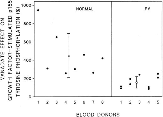 Fig. 8. Response of normal and PV SCFR tyrosine phosphorylation intensity to treatment with vanadate. Cell lysates from 8 normal donors and 5 PV patients were treated as described in the legend for Fig 7. Scanning densitometry was performed using the LKB 2222-010 UltroScan XL Laser Densitometer. The intensity measured in the controls not treated with vanadate was taken as 100%. The purity of the PV ECFC from 5 patients, including repeat cultures, ranged from 39% ± 8% to 79% ± 6% and from 8 normal donors ranged from 34% ± 4% to 79% ± 2%.