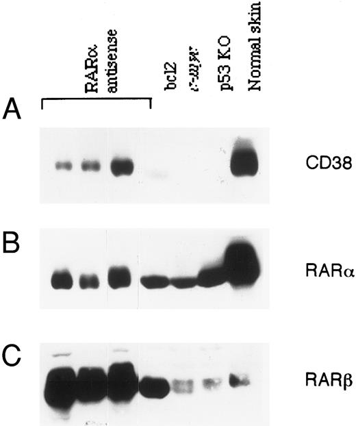 Fig. 6. Expression of CD38, RAR-α, and RAR-β proteins in lymphomas. Lymphomas that developed spontaneously in RAR-α antisense homozygous mice, bcl-2 transgenic mice, c-myc transgenic mice, or p53 knockout mice were homogenized, and the soluble extracts (100 μg) were resolved on SDS-PAGE, transferred to nitrocellulose membrane, and probed with anti-CD38 antibody (A). After stripping, the membrane was reprobed with RAR-α–specific (B) or RAR-β–specific antibody (C). Protein extract of skin from a normal mouse was loaded in parallel as a reference.