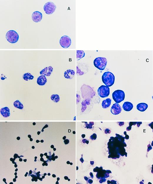 Fig. 3. (A through C) Cytospin analysis of flASK cells. (A) Cytospin preparations of flASK cells immediately after cell sorting or after suspension culture in (B) control CM plus 25 ng/mL KL or (C) WNT-5a CM plus KL. (D and E) Formation of adherent hematopoietic foci after cells were plated onto fibronectin-coated glass chamber slides and cultured for 4 days. Cells were fixed and stained in situ to preserve the intercellular organization of the foci. (D) Control CM plus 25 ng/mL KL. (E) WNT-5a CM (gDWnt5a) plus 25 ng/mL KL. Notice that, in (E), WNT-5a CM results in a dramatic enhancement of foci formation in which blast cells are found as adherent clusters overlying adherent cells.