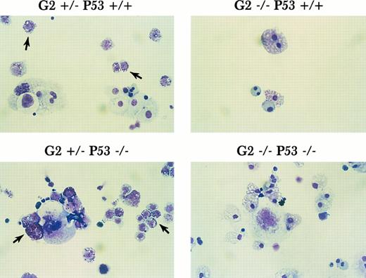 Fig. 7. Hematopoietic potential of yolk sac cells with various genotypes. Yolk sac cells collected at E9.5 were subjected to in vitro liquid culture with KL, IL-11, IL-3, and Epo. Hematopoietic cells grown after 10 days in culture were cytocentrifuged onto slides and stained with May-Grünwald/Giemsa. The arrow points to mast cells.