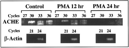 Fig. 4. Suppression of E6-ACHEmRNA levels under PMA. Presented is a semiquantitative kinetic follow-up of RT-PCR amplification of cell cultures RNA. Later appearance of ACHEmRNA-derived products reflects lower levels (by approximately eightfold for a three cycle difference3 ). Continuous decrease in the level of E6 ACHEmRNA caused progressively later appearance of the corresponding PCR product of mRNA from cell cultures treated for 12 and 24 hours with PMA as compared with control cells. The appearance of actin mRNA products remained unchanged, excluding the possibility of total mRNA destruction. PCR cycle numbers at which samples were withdrawn are noted above.