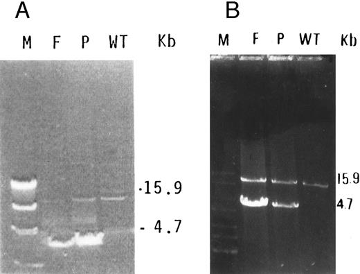 Fig. 3. (A) Long PCR of genomic DNA using primers flanking exons 9 (9F ) and 13 (13R) of the GPIIIa gene. A normally amplified 15.9-kb fragment is seen in control DNA (WT) in the proband (P) and very faintly in her father (F ). An additional 4.7-kb fragment is seen in both the proband and her father. The λ DNA molecular weight marker cleaved with HindIII (M) is shown in the left lane. (B) Reamplification of the previous PCR products using reverse primer in exon 13 (M13R) and the same forward primer (9F ) shows more clearly the 15.9-kb fragment in the normal allele, in the proband (P), and in her father (F ).