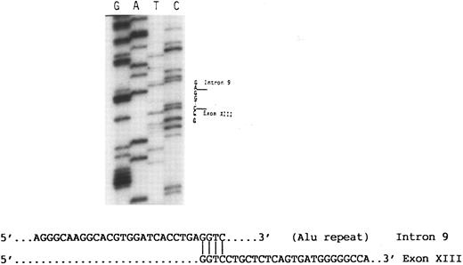 Fig. 4. Partial nucleotide sequence analysis of the abnormal 4.7-kb fragment (Fig 3). A sequence of an Alu repeat in intron 9 is followed by a sequence derived from exon 13. Note that the homologous nucleotide sequence GGTC in intron 9 and exon 13 at their junction appears only once in the abnormal fragment.