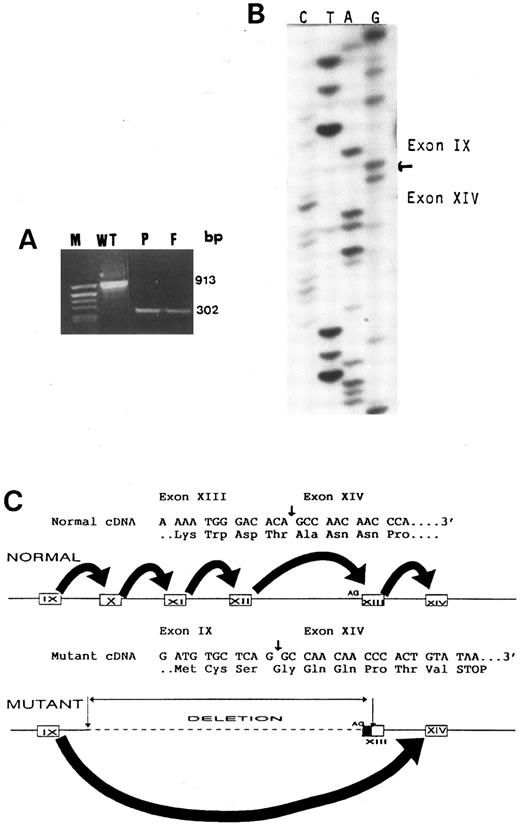 Fig. 5. (A) PCR amplification of platelet cDNA (RT-mRNA) using primers flanking exons 9 and 14 shows a 913-bp fragment in a control (WT) and a 302-bp fragment in the proband (P) and her father (F ). The molecular weight marker pBR322 DNA cleaved with Alu I (M) is in the left lane. (B) Nucleotide sequence analysis of the mutant cDNA showing that exon 9 is followed by exon 14. (C) A schematic representation of both normal and mutant genes and their respective mRNA splicings. Because the large deletion includes the AG acceptor site of exon 13, exon 9 is spliced directly to exon 14, skipping the remaining part of exon 13. Direct splicing of exon 9 to 14 in the mutant cDNA is predicted to cause a shift in the reading frame, creating a stop codon after 6 abberant amino acids.