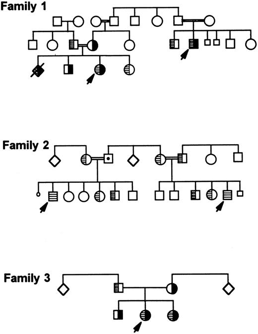 Fig. 7. Three Iraqi-Jewish families carrying both I-J1 and I-J2 mutations or only the I-J2 mutation. I-J1 mutation is shown in black, and I-J2 mutation is marked by hatching inside symbols. Family 1 is the index family that depicts an aborted fetus who was prenatally diagnosed as a compound heterozygote similarly to the proband.