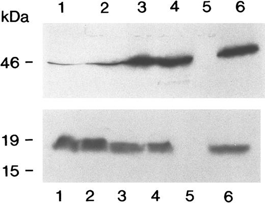 Fig. 2. Immunoprecipitation assays of inhibitor plasmas with the A2 and C2 domains. The upper panel shows the results of SDS-PAGE analysis of inhibitor binding to 35S-A2. The patients tested were R7717, R3511, R1911, and R1113 in lanes 1 to 4, respectively. Lane 5 is the negative control without antibody, and lane 6 is the positive control of anti-A2 MoAb 413. In the lower panel depicting 35S-C2 binding, the patient samples and controls are arranged in the same order. The anti-C2 MoAb ESH8 was used as the positive control.