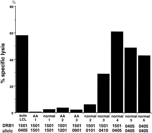 Fig. 6. Cytotoxicity of NT4.2 cells against allo LCLs that share HLA-DRB1*1501 or HLA-DRBI*0405. A total of 5 × 104 NT4.2 cells were incubated with 5 × 103 51Cr-labeled auto LCL cells or allo LCL cells from aplastic anemia patients and normal individuals that share HLA-DRB1*1501 or HLA-DRB1*0405, and 51Cr release was determined. Data are expressed as a mean of triplicate cultures.