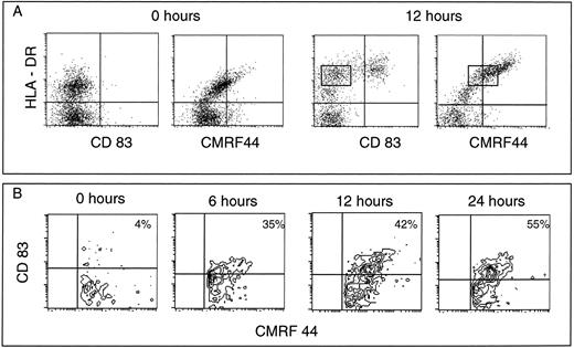 Fig. 2. CMRF-44 positive blood DC can be detected before culture. (A) Mature lineage positive mononuclear cells were removed by magnetic immunodepletion. The resulting lineage negative cells were labeled before (0 hours) and after 12 hours culture. A lineage negative, CMRF-44 positive subpopulation is noted. The differential expression of the activation antigens recognized by CMRF-44, HB15a (CD83), and anti-HLA-DR antibodies allow the identification of distinct stages of early DC development (see text). The rectangle indicates the CMRF44+/CD83− stage of DC differentiation . (B) Time course labeling of cultured lineage negative cells gated on CMRF-44 positive cells showing the differential expression of the CMRF-44 and CD83 antigens. No CD83+/CMRF-44− cells were detected at any time point. Quadrants are placed according to isotype-matched negative controls such that <95% of events are excluded from the right-hand quadrants. Results are from one of three similar experiments.