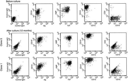 Fig. 2. Leukemic cells retain their immunophenotypic features after long-term culture on stroma. Double-color flow cytometric dot-plots illustrate the cell marker profile of cells from case no. 3 before culture (top panels) and after 12 months of culture (middle and bottom panels). Cells after culture were obtained from clones initiated by single leukemic cells. Antibodies were conjugated to FITC (X axes) or PE (Y axes). Most leukemic cells expressed CD19, cytoplasmic μ (cIgM), terminal deoxynucleotidyl transferase (TdT), and CD10; a proportion also expressed CD15. Expression of TdT and cytoplasmic μ was confirmed by fluorescence microscopy (not shown). Cells did not express sIg, CD13, and CD3. The immunophenotype of the other three clones was identical to that of the clones shown.