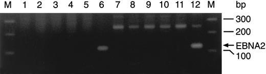 Fig. 3. Lack of EBNA-2 expression in cultured leukemic lymphoblasts. PCR amplification of EBNA-2a (lanes 1 through 6) and EBNA-2b (lanes 7 through 12) in 3 clones initiated from single leukemic cells (cases no. 1, 3, and 4) after 5 months of culture (lanes 2 through 4 and 8 through 10), in the EBNA-2a– (AD; lanes 6 and 11) and EBNA-2b– (C2BL16; lanes 5 and 12) positive cell lines, and in placenta DNA (negative control; lanes 1 and 7). The 116-bp (EBNA-2a) and 119-bp (EBNA-2b) PCR products could only be detected in the EBNA-2–positive lines. External lanes contain a molecular weight marker.