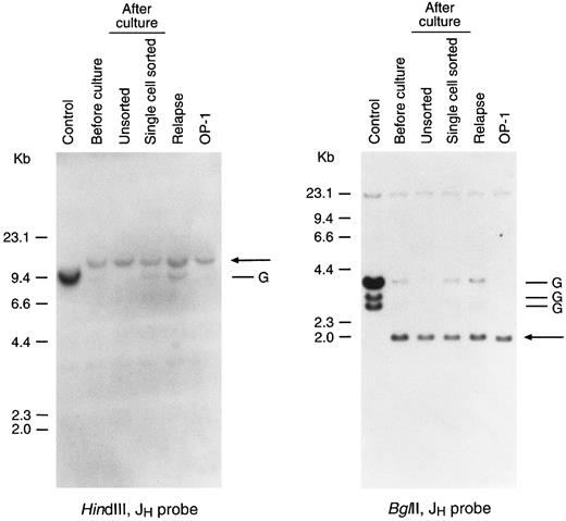 Fig. 5. Leukemic lymphoblasts after culture retain Ig gene rearrangement in the same configuration determined before culture. Shown is the Southern blot analysis of Ig gene rearrangements in leukemic cells from case no. 4 obtained before culture and after 2 months of culture on stroma. The latter cells were derived from a bulk culture and from a culture initiated by a single leukemic cell. DNA obtained from the relapse sample and from a stroma-independent cell line (OP-1) originated from the diagnostic sample were also analyzed. DNA was digested with the restriction enzymes indicated and probed with a JH probe. Arrows point to the rearranged bands; G corresponds to the germline bands. KB epidermoid carcinoma line was used as a control.