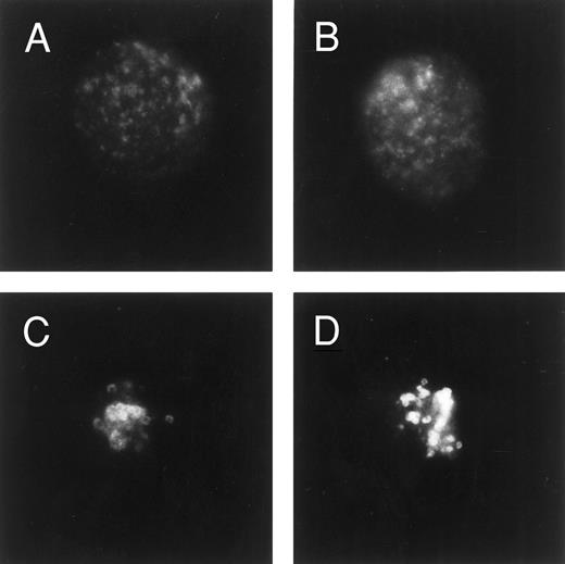 Fig. 2. Immunofluorescence analysis of LAMP-1 expression. Cells were fixed/permeabilized in ethanol before blocking in goat serum, incubating with LAMP-1 MoAb, and then exposing to an FITC second step. Cells were examined by fluorescence microscopy and photographed. Shown are photographs of typical single cells (centered within the frame) from parental U-937 cells (A and B) or U-A10 cells (C and D).
