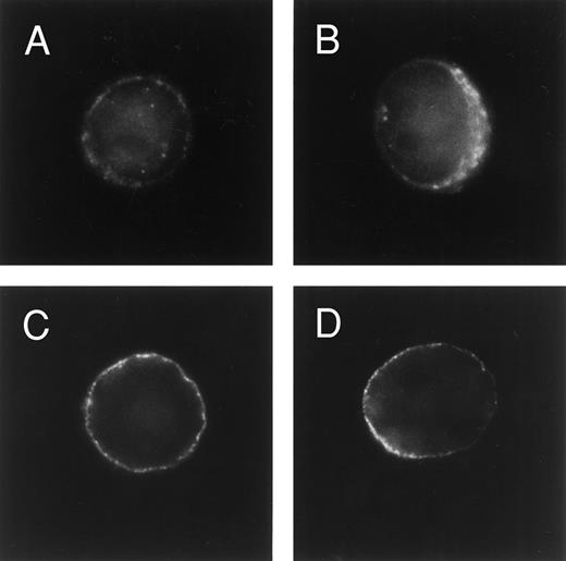 Fig. 3. Immunofluorescence analysis of MRP and P-glycoprotein expression. U-A10 cells were fixed/permeabilized in ethanol, blocked with goat serum, incubated with polyclonal antibody MRP-6KQ (A and B) or MoAb C219 (C and D), and then exposed to an FITC-conjugated second step. Cells were examined by fluorescence microscopy and photographed. Shown are photographs of typical single cells that are centered within the frame.