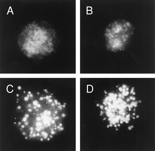 Fig. 5. Daunorubicin distribution in cytoplasts prepared from U-937 and U-A10 cells. Cytoplasts (enucleated cells) were prepared from U-937 cells (A and B) and from U-A10 cells (C and D) by treating cells with cytochalasin B and then pelleting through a discontinuous Ficoll gradient. Cytoplasts were exposed to daunorubicin at 500 ng/mL for 1 hour before being washed, visualized by fluorescence microscopy, and photographed. Shown are photographs of typical single cytoplasts with the images centered within the frame.