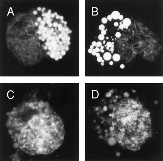 Fig. 8. Effect of chloroquine on cellular daunorubicin distribution. U-A10 cells were exposed to chloroquine (0 to 100 μmol/L) for 2 hours before the addition of daunorubicin to a final concentration of 500 ng/mL for 1 hour. The cells were then washed, visualized by fluorescence microscopy, and photographed. Shown are photographs of typical single cells (with images centered within the frame) after treatment with 10 μmol/L chloroquine (A and B) or 100 μmol/L chloroquine (C and D) before daunorubicin exposure.
