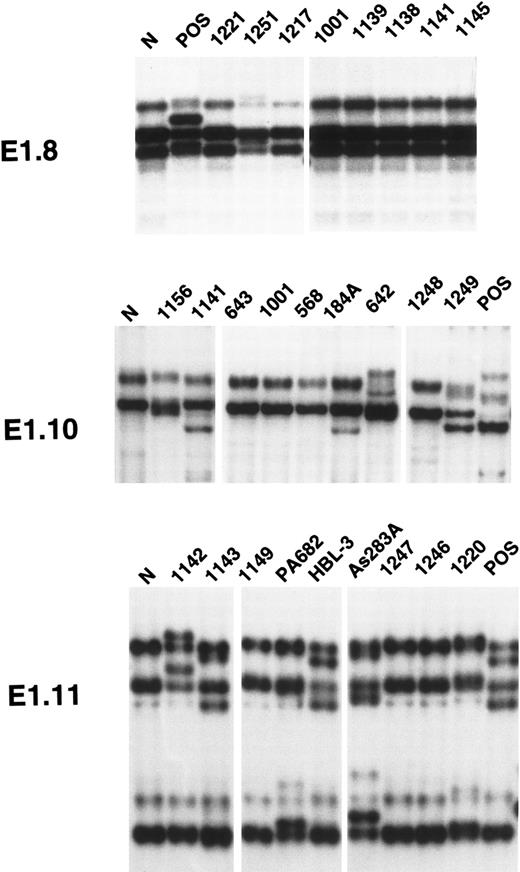Fig. 1. PCR-SSCP analysis of mutations of the 5′ noncoding regions of BCL-6 in AIDS-NHL. Representative results obtained for PCR products E1.8 (located within BCL-6 exon 1), E1.10, and E1.11 (both located within BCL-6 intron 1) are shown. Each AIDS-NHL sample is indicated at the top of each lane by a numbered code or, in the case of AIDS-NHL cell lines, by its conventional denomination. A positive control (POS), represented by a tumor sample known to harbor BCL-6 mutations,19 as well as a normal (N) sample, represented by a B-lymphoblastoid cell line, are also included for each PCR-SSCP fragment shown. Samples were scored positive when their migration pattern differed from the normal control (N) and their migration abnormalities could not be ascribed to population polymorphisms. Among the AIDS-NHL samples shown in the figure, cases scored as positive included cases 1251 (for PCR product E1.8), 1141, 184A, 642, 1249 (for PCR product E1.10), 1142, 1143, PA682, HBL-3, As283A and 1220 (for PCR product E1.11).
