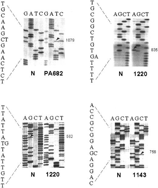 Fig. 2. Nucleotide sequencing analyses of mutations of the 5′ noncoding regions of BCL-6 in AIDS-NHL. For each sample, a mixture of ≥ 20 subclones was subjected to nucleotide sequencing (see Materials and Methods). The sequence of each AIDS-NHL case shown in the figure is matched to the sequence of a normal control (N) displaying germline BCL-6 alleles. The position of mutations is indicated by the nucleotide number of the corresponding BCL-6 germline sequence (the first nucleotide of the BCL-6 cDNA was arbitrarily chosen as position +1). Arrowheads point to bands corresponding to mutations.