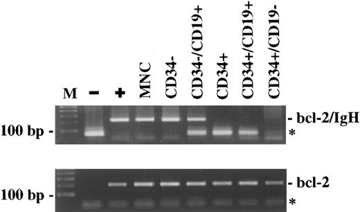 Fig. 3. BM-CD34+ cells do not contain the t(14; 18) translocation. CD34+ cells were enriched to high purity using an immunomagnetic technique, followed by FACS sorting for CD34 and CD19 expression. The DNA extracted from the different subpopulations was amplified by a sensitive PCR method for the detection of bcl-2/IgH rearrangement. The PCR results from one representative patient (K.A.) are shown. (M), 100 bp DNA-ladder; (−), negative control; (+), patient-specific positive control; (MNC), mononuclear cells; (*), primer-dimers.